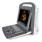 CHISON Ultrasound, Ultrasound, Ultrasound Systems, Ultrasound Machine for Sale